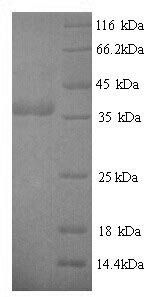 SDS-PAGE separation of QP8795 followed by commassie total protein stain results in a primary band consistent with reported data for cagA. These data demonstrate Greater than 90% as determined by SDS-PAGE.