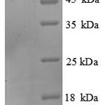 SDS-PAGE separation of QP8798 followed by commassie total protein stain results in a primary band consistent with reported data for SEPSECS. These data demonstrate Greater than 90% as determined by SDS-PAGE.