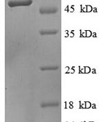 SDS-PAGE separation of QP8798 followed by commassie total protein stain results in a primary band consistent with reported data for SEPSECS. These data demonstrate Greater than 90% as determined by SDS-PAGE.