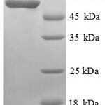 SDS-PAGE separation of QP8802 followed by commassie total protein stain results in a primary band consistent with reported data for Cystathionine beta-synthase. These data demonstrate Greater than 90% as determined by SDS-PAGE.