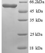 SDS-PAGE separation of QP8802 followed by commassie total protein stain results in a primary band consistent with reported data for Cystathionine beta-synthase. These data demonstrate Greater than 90% as determined by SDS-PAGE.