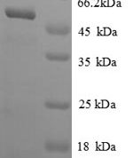 SDS-PAGE separation of QP8805 followed by commassie total protein stain results in a primary band consistent with reported data for Adenosylhomocysteinase. These data demonstrate Greater than 90% as determined by SDS-PAGE.