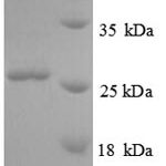 SDS-PAGE separation of QP8807 followed by commassie total protein stain results in a primary band consistent with reported data for ORM2. These data demonstrate Greater than 90% as determined by SDS-PAGE.