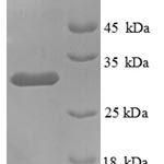 SDS-PAGE separation of QP8809 followed by commassie total protein stain results in a primary band consistent with reported data for KNG1 / BDK / kininogen-1. These data demonstrate Greater than 90% as determined by SDS-PAGE.