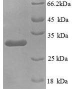 SDS-PAGE separation of QP8809 followed by commassie total protein stain results in a primary band consistent with reported data for KNG1 / BDK / kininogen-1. These data demonstrate Greater than 90% as determined by SDS-PAGE.