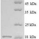 SDS-PAGE separation of QP8810 followed by commassie total protein stain results in a primary band consistent with reported data for Angiogenin-1. These data demonstrate Greater than 90% as determined by SDS-PAGE.