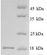 SDS-PAGE separation of QP8810 followed by commassie total protein stain results in a primary band consistent with reported data for Angiogenin-1. These data demonstrate Greater than 90% as determined by SDS-PAGE.