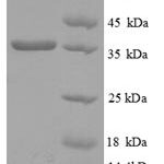 SDS-PAGE separation of QP8825 followed by commassie total protein stain results in a primary band consistent with reported data for HLA-C. These data demonstrate Greater than 90% as determined by SDS-PAGE.