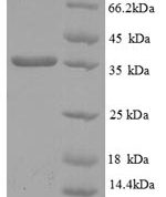 SDS-PAGE separation of QP8825 followed by commassie total protein stain results in a primary band consistent with reported data for HLA-C. These data demonstrate Greater than 90% as determined by SDS-PAGE.