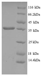 SDS-PAGE separation of QP8825 followed by commassie total protein stain results in a primary band consistent with reported data for HLA-C. These data demonstrate Greater than 90% as determined by SDS-PAGE.