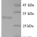 SDS-PAGE separation of QP8828 followed by commassie total protein stain results in a primary band consistent with reported data for FOXP3 / Scurfin. These data demonstrate Greater than 90% as determined by SDS-PAGE.