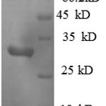 SDS-PAGE separation of QP8830 followed by commassie total protein stain results in a primary band consistent with reported data for MAP3K1. These data demonstrate Greater than 90% as determined by SDS-PAGE.