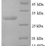 SDS-PAGE separation of QP8831 followed by commassie total protein stain results in a primary band consistent with reported data for CALCA / CGRP. These data demonstrate Greater than 90% as determined by SDS-PAGE.