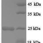 SDS-PAGE separation of QP8837 followed by commassie total protein stain results in a primary band consistent with reported data for HRAS / GTPase Hras. These data demonstrate Greater than 90% as determined by SDS-PAGE.