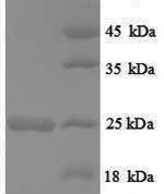 SDS-PAGE separation of QP8837 followed by commassie total protein stain results in a primary band consistent with reported data for HRAS / GTPase Hras. These data demonstrate Greater than 90% as determined by SDS-PAGE.