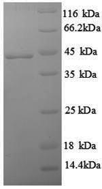 SDS-PAGE separation of QP8840 followed by commassie total protein stain results in a primary band consistent with reported data for IFNG / Interferon Gamma Protein. These data demonstrate Greater than 90% as determined by SDS-PAGE.