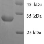 SDS-PAGE separation of QP8843 followed by commassie total protein stain results in a primary band consistent with reported data for Vasopressin V1a receptor. These data demonstrate Greater than 90% as determined by SDS-PAGE.