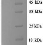 SDS-PAGE separation of QP8844 followed by commassie total protein stain results in a primary band consistent with reported data for Vasopressin V1b receptor. These data demonstrate Greater than 90% as determined by SDS-PAGE.