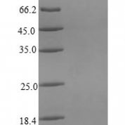 SDS-PAGE separation of QP8845 followed by commassie total protein stain results in a primary band consistent with reported data for Interleukin-8. These data demonstrate Greater than 80% as determined by SDS-PAGE.