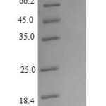 SDS-PAGE separation of QP8847 followed by commassie total protein stain results in a primary band consistent with reported data for AKT1 / PKB / PKBalpha. These data demonstrate Greater than 80% as determined by SDS-PAGE.