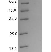 SDS-PAGE separation of QP8847 followed by commassie total protein stain results in a primary band consistent with reported data for AKT1 / PKB / PKBalpha. These data demonstrate Greater than 80% as determined by SDS-PAGE.