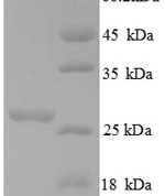 SDS-PAGE separation of QP8856 followed by commassie total protein stain results in a primary band consistent with reported data for Chitin synthase 1. These data demonstrate Greater than 90% as determined by SDS-PAGE.