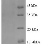 SDS-PAGE separation of QP8858 followed by commassie total protein stain results in a primary band consistent with reported data for Lysine decarboxylase