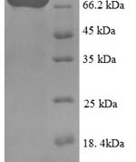 SDS-PAGE separation of QP8858 followed by commassie total protein stain results in a primary band consistent with reported data for Lysine decarboxylase