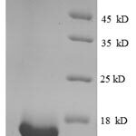 SDS-PAGE separation of QP8870 followed by commassie total protein stain results in a primary band consistent with reported data for CLPS / Colipase. These data demonstrate Greater than 90% as determined by SDS-PAGE.