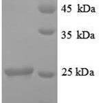 SDS-PAGE separation of QP8876 followed by commassie total protein stain results in a primary band consistent with reported data for TIMP-1 / TIMP1. These data demonstrate Greater than 90% as determined by SDS-PAGE.