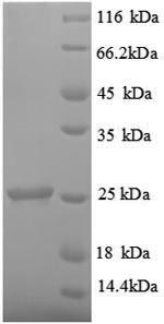SDS-PAGE separation of QP8876 followed by commassie total protein stain results in a primary band consistent with reported data for TIMP-1 / TIMP1. These data demonstrate Greater than 90% as determined by SDS-PAGE.