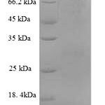 SDS-PAGE separation of QP8877 followed by commassie total protein stain results in a primary band consistent with reported data for CD106 / VCAM1. These data demonstrate Greater than 90% as determined by SDS-PAGE.