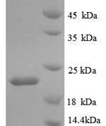 SDS-PAGE separation of QP8880 followed by commassie total protein stain results in a primary band consistent with reported data for IL18BP. These data demonstrate Greater than 90% as determined by SDS-PAGE.