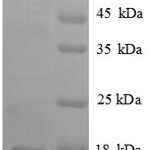 SDS-PAGE separation of QP8881 followed by commassie total protein stain results in a primary band consistent with reported data for beta-NGF / Beta-NGF Protein. These data demonstrate Greater than 90% as determined by SDS-PAGE.