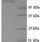 SDS-PAGE separation of QP8884 followed by commassie total protein stain results in a primary band consistent with reported data for Angiopoietin-2 / ANG2. These data demonstrate Greater than 90% as determined by SDS-PAGE.