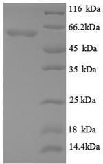 SDS-PAGE separation of QP8884 followed by commassie total protein stain results in a primary band consistent with reported data for Angiopoietin-2 / ANG2. These data demonstrate Greater than 90% as determined by SDS-PAGE.