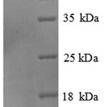 SDS-PAGE separation of QP8885 followed by commassie total protein stain results in a primary band consistent with reported data for Alkaline Phosphatase / ALPL. These data demonstrate Greater than 90% as determined by SDS-PAGE.