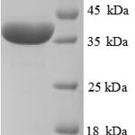 SDS-PAGE separation of QP8887 followed by commassie total protein stain results in a primary band consistent with reported data for Haptoglobin. These data demonstrate Greater than 90% as determined by SDS-PAGE.