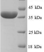 SDS-PAGE separation of QP8887 followed by commassie total protein stain results in a primary band consistent with reported data for Haptoglobin. These data demonstrate Greater than 90% as determined by SDS-PAGE.