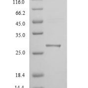 SDS-PAGE separation of QP8888 followed by commassie total protein stain results in a primary band consistent with reported data for KIM-1 / TIM1. These data demonstrate Greater than 90% as determined by SDS-PAGE.