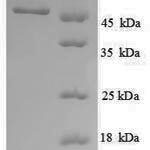 SDS-PAGE separation of QP8889 followed by commassie total protein stain results in a primary band consistent with reported data for UDP-glucose 6-dehydrogenase. These data demonstrate Greater than 90% as determined by SDS-PAGE.