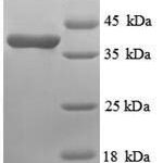 SDS-PAGE separation of QP8890 followed by commassie total protein stain results in a primary band consistent with reported data for Annexin A3. These data demonstrate Greater than 90% as determined by SDS-PAGE.