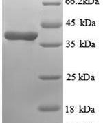 SDS-PAGE separation of QP8890 followed by commassie total protein stain results in a primary band consistent with reported data for Annexin A3. These data demonstrate Greater than 90% as determined by SDS-PAGE.