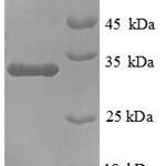 SDS-PAGE separation of QP8891 followed by commassie total protein stain results in a primary band consistent with reported data for MUC5AC. These data demonstrate Greater than 90% as determined by SDS-PAGE.