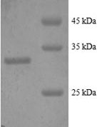 SDS-PAGE separation of QP8894 followed by commassie total protein stain results in a primary band consistent with reported data for Metallothionein-2. These data demonstrate Greater than 90% as determined by SDS-PAGE.