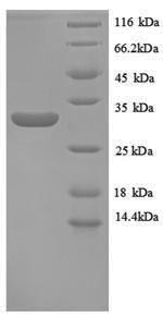 SDS-PAGE separation of QP8895 followed by commassie total protein stain results in a primary band consistent with reported data for Metallothionein-1E. These data demonstrate Greater than 90% as determined by SDS-PAGE.