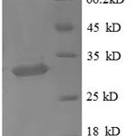 SDS-PAGE separation of QP8896 followed by commassie total protein stain results in a primary band consistent with reported data for Metallothionein-1X. These data demonstrate Greater than 90% as determined by SDS-PAGE.