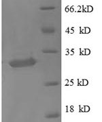 SDS-PAGE separation of QP8896 followed by commassie total protein stain results in a primary band consistent with reported data for Metallothionein-1X. These data demonstrate Greater than 90% as determined by SDS-PAGE.