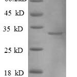 SDS-PAGE separation of QP8898 followed by commassie total protein stain results in a primary band consistent with reported data for Metallothionein-1A. These data demonstrate Greater than 90% as determined by SDS-PAGE.