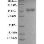 SDS-PAGE separation of QP8906 followed by commassie total protein stain results in a primary band consistent with reported data for HDAC4. These data demonstrate Greater than 90% as determined by SDS-PAGE.